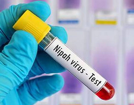 Antibody for Nipah treatment arrived in Kerala: Govt